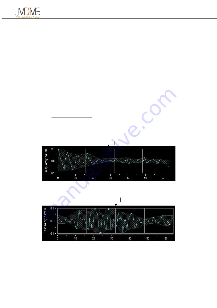 MDMS ANI Monitor V2 User Manual Download Page 18