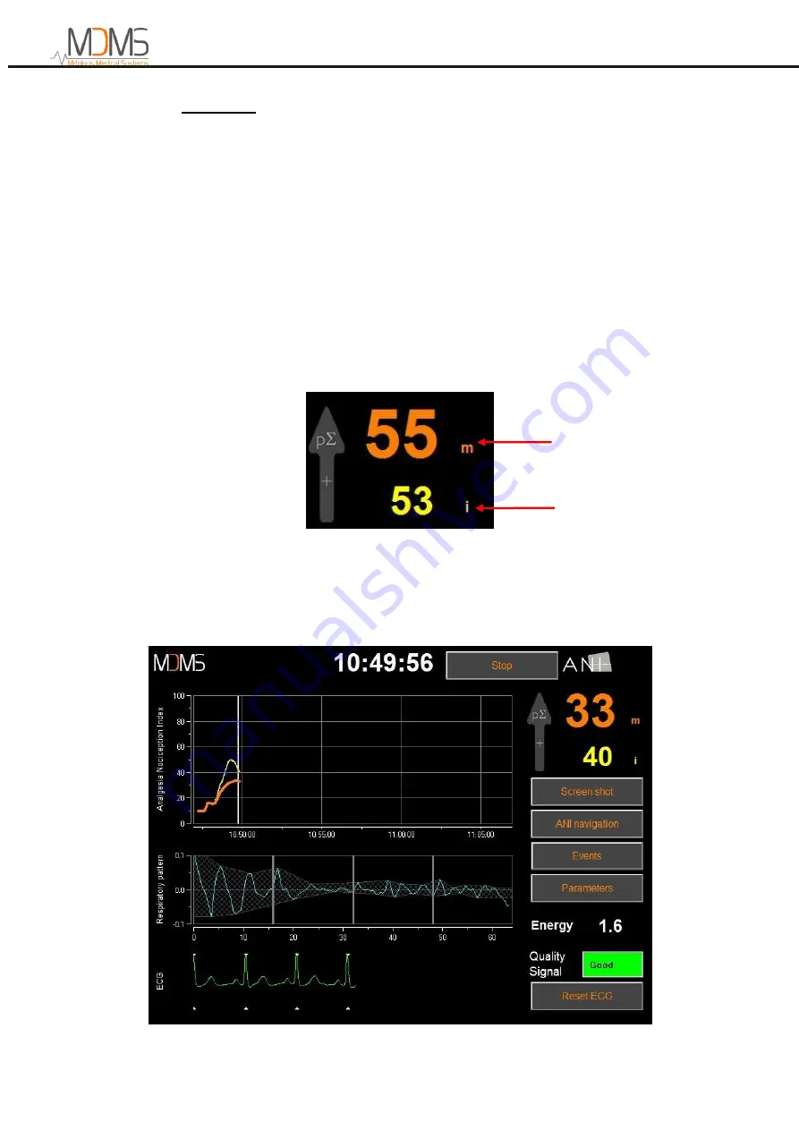 MDMS ANI Monitor V2 User Manual Download Page 19