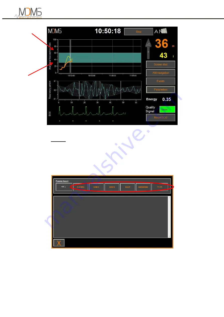 MDMS ANI Monitor V2 Скачать руководство пользователя страница 23