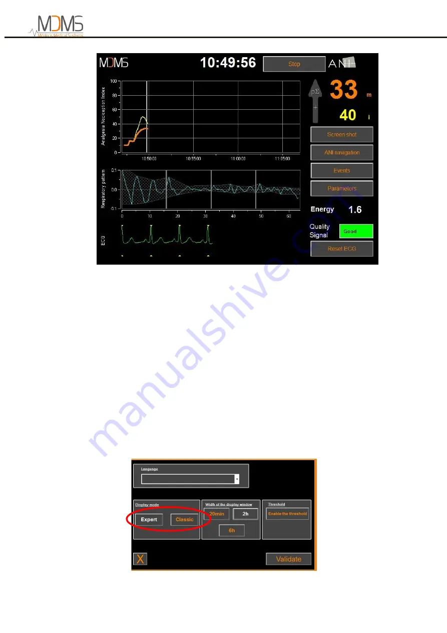 MDMS ANI Monitor V2 User Manual Download Page 26