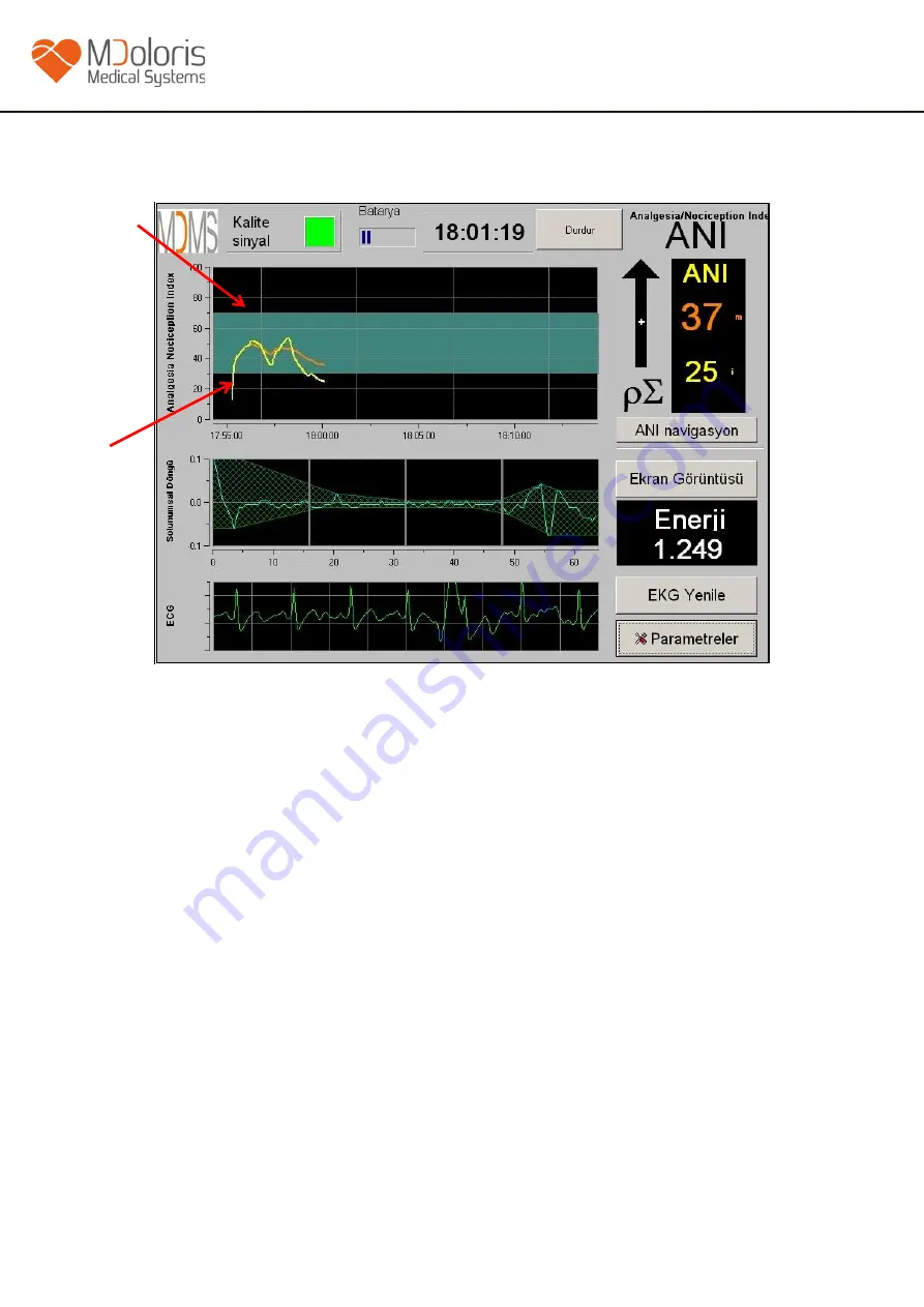 Mdoloris ANI V1 User Manual Download Page 28