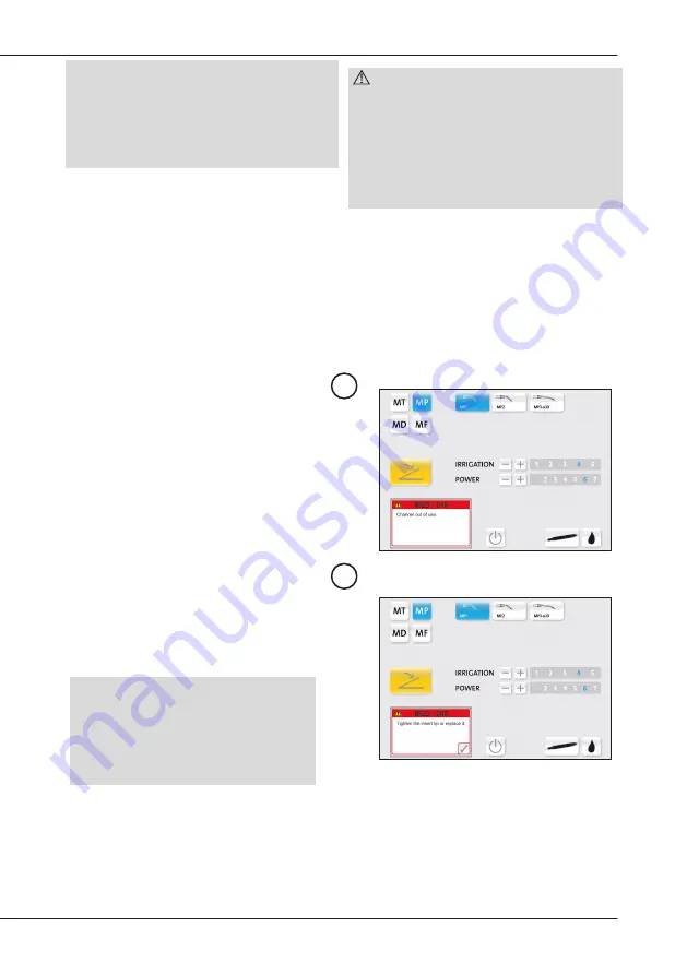 mectron PIEZOSURGERY plus Use And Maintenance Manual Download Page 47