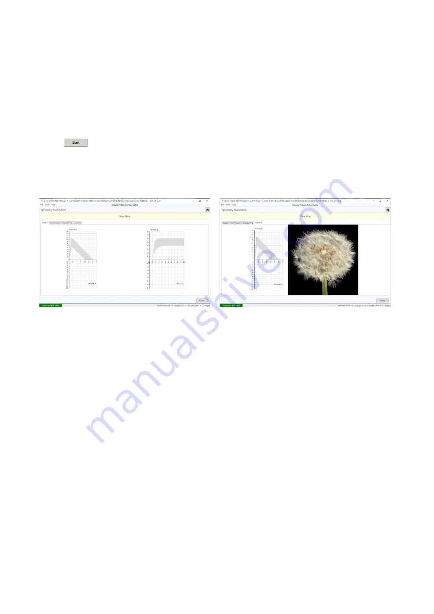 MedChip Solutions SpiroConnect Скачать руководство пользователя страница 10