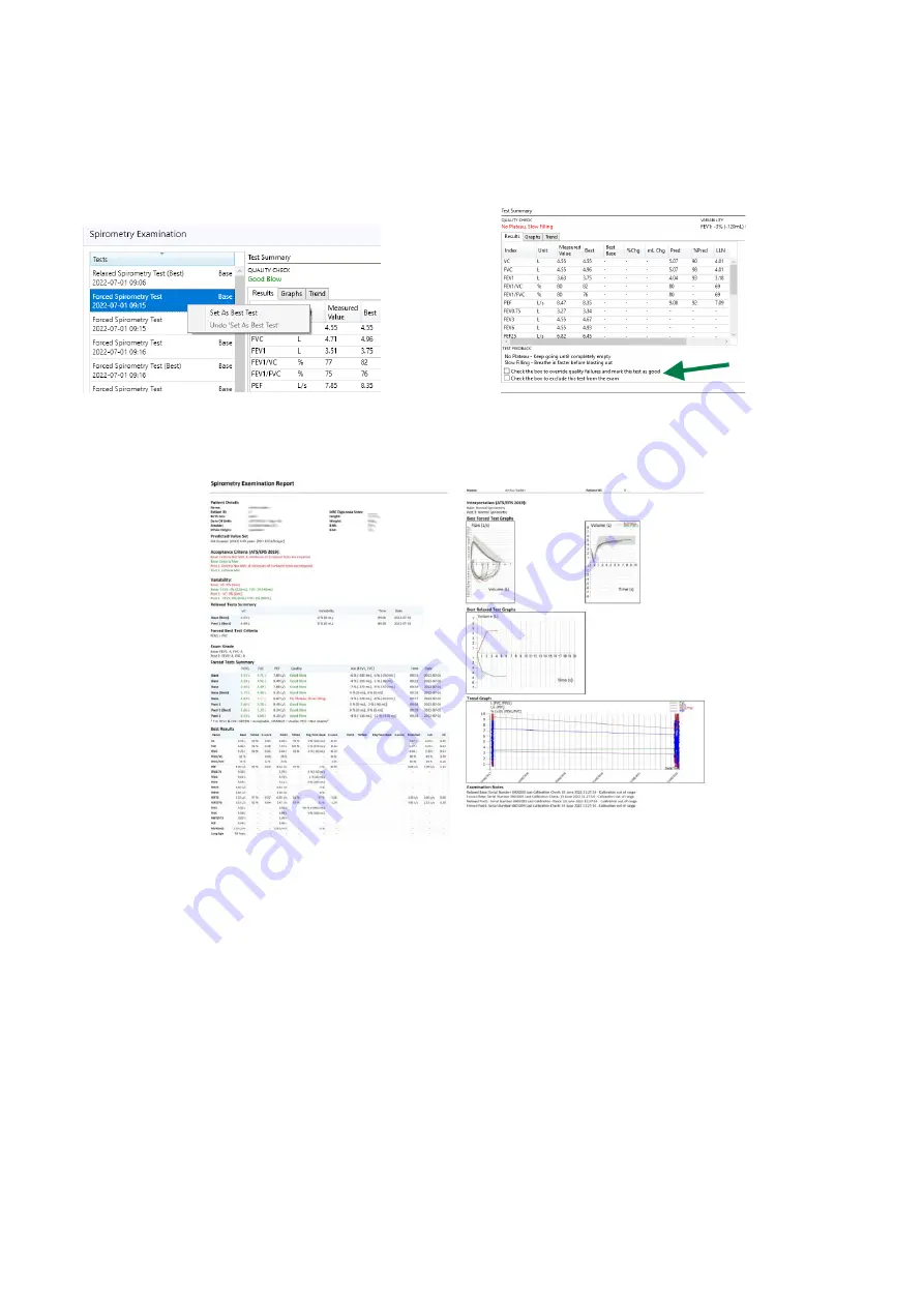 MedChip Solutions SpiroConnect Скачать руководство пользователя страница 18