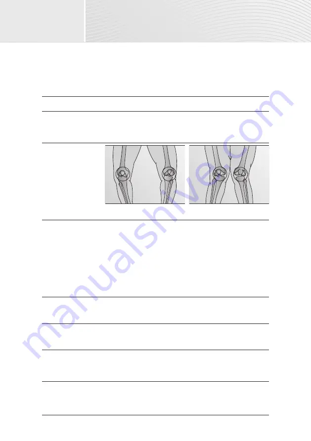 medi protect.4 OA Instructions For Use Manual Download Page 28