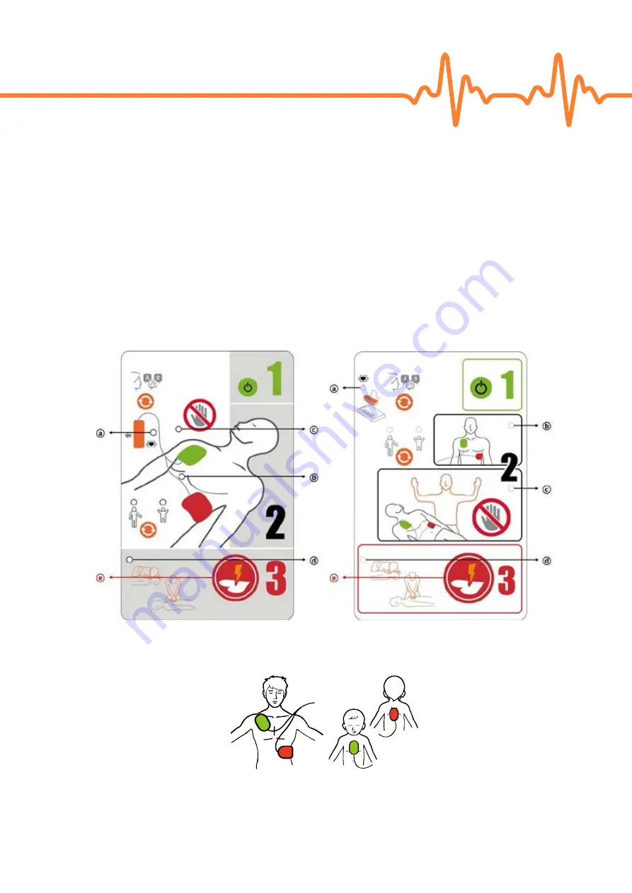 Mediana A16M-DF-0E Operator'S Manual Download Page 36