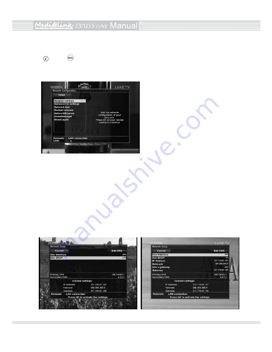 Medi@link IXUSS ONE User Manual Download Page 46