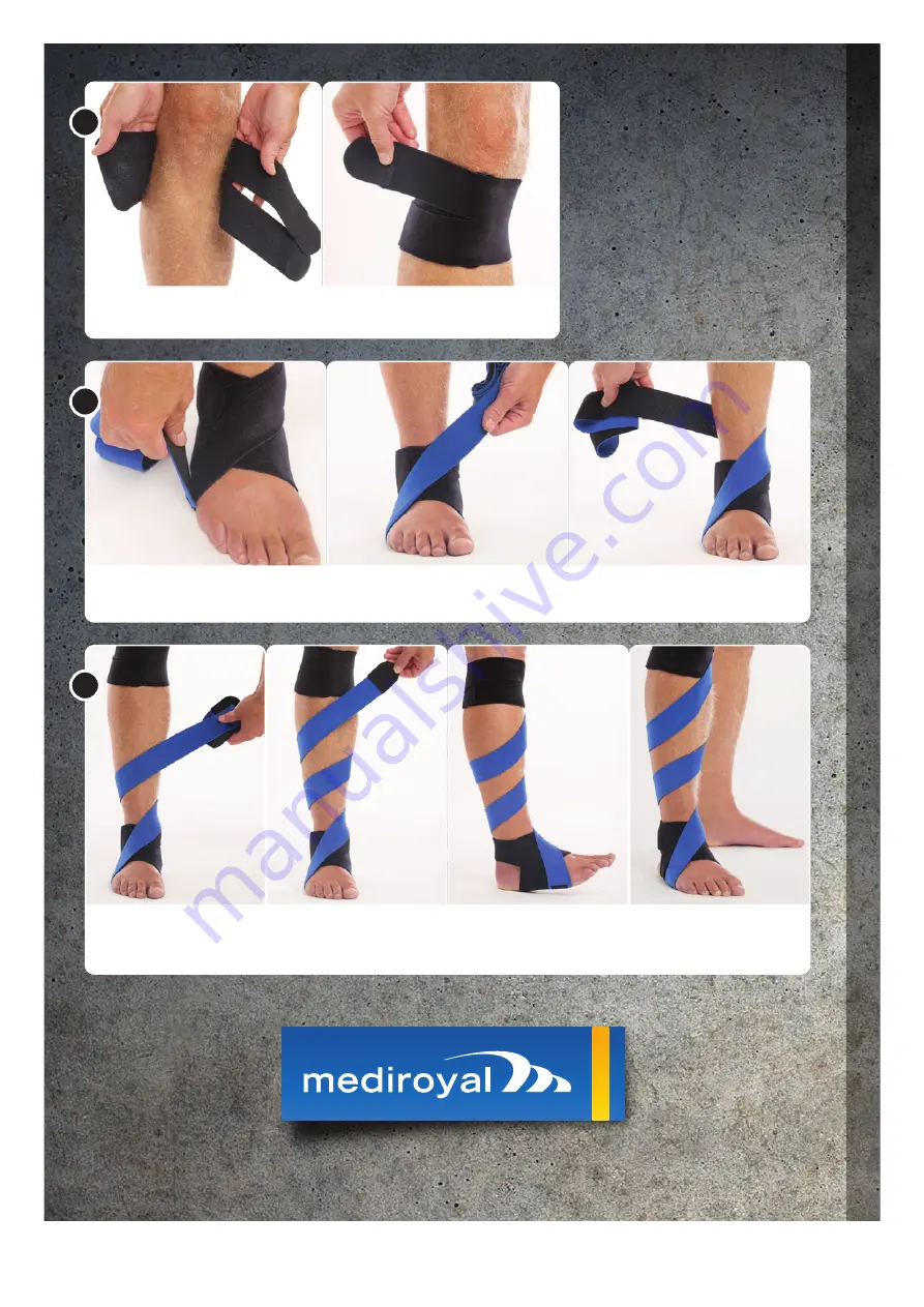 Mediroyal NRX Foot Drop Скачать руководство пользователя страница 2