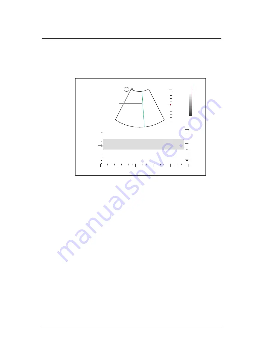 MediSono P25 EXP User Manual Download Page 106