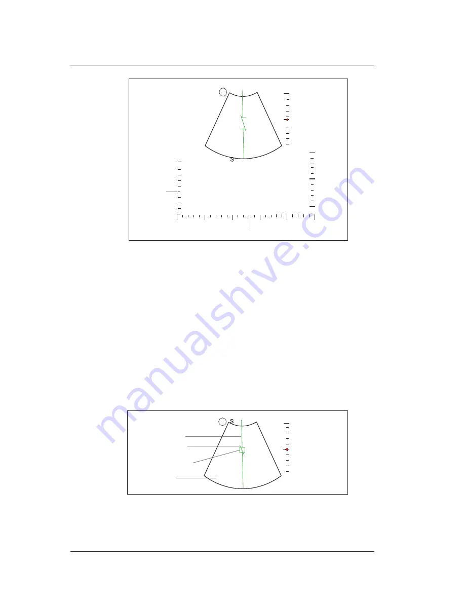 MediSono P25 EXP User Manual Download Page 112