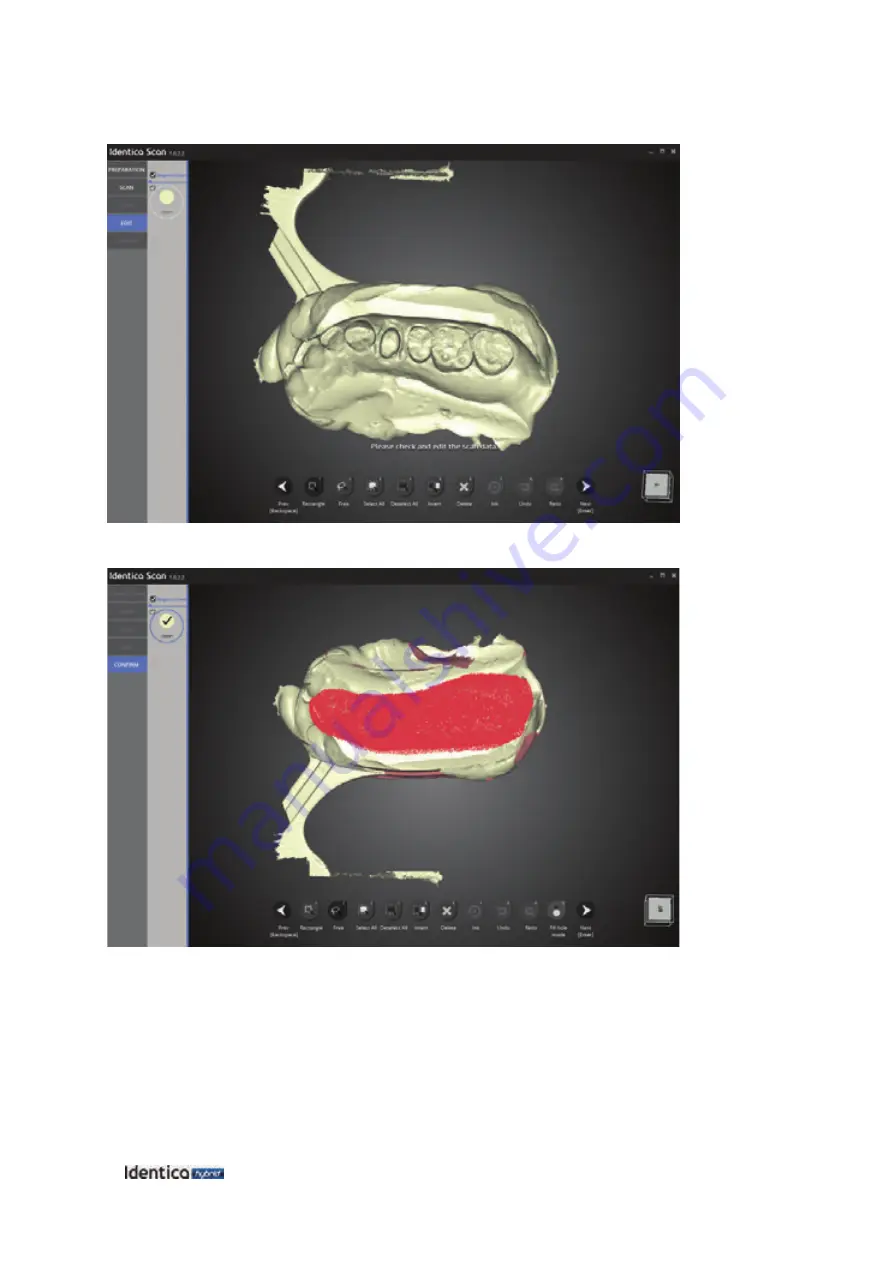 Medit Identica hybrid User Manual Download Page 95