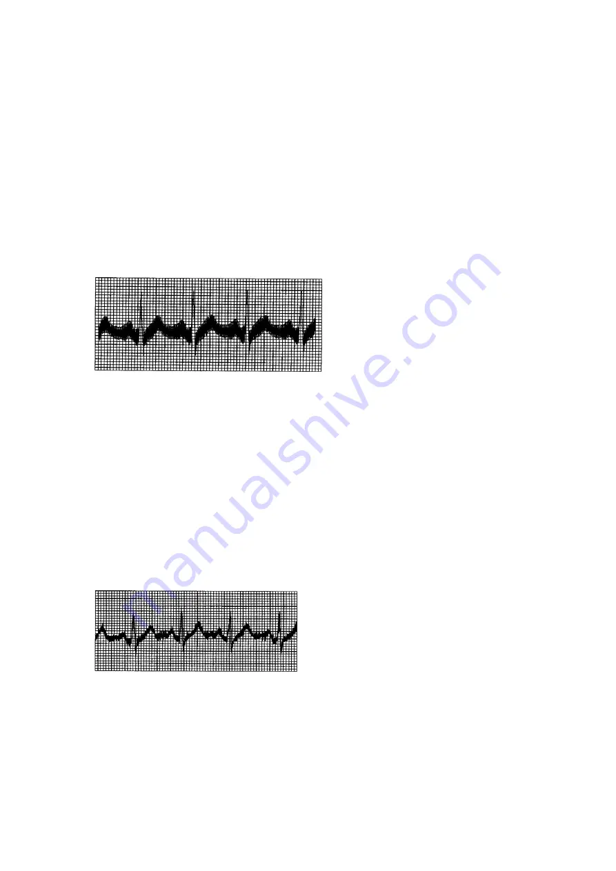 Meditech EKG-312T User Manual Download Page 35