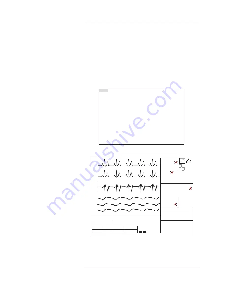 Medrad Veris 8600 Operation Manual Download Page 63