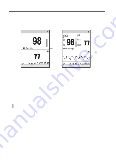 MedSource MS-74011 Скачать руководство пользователя страница 7