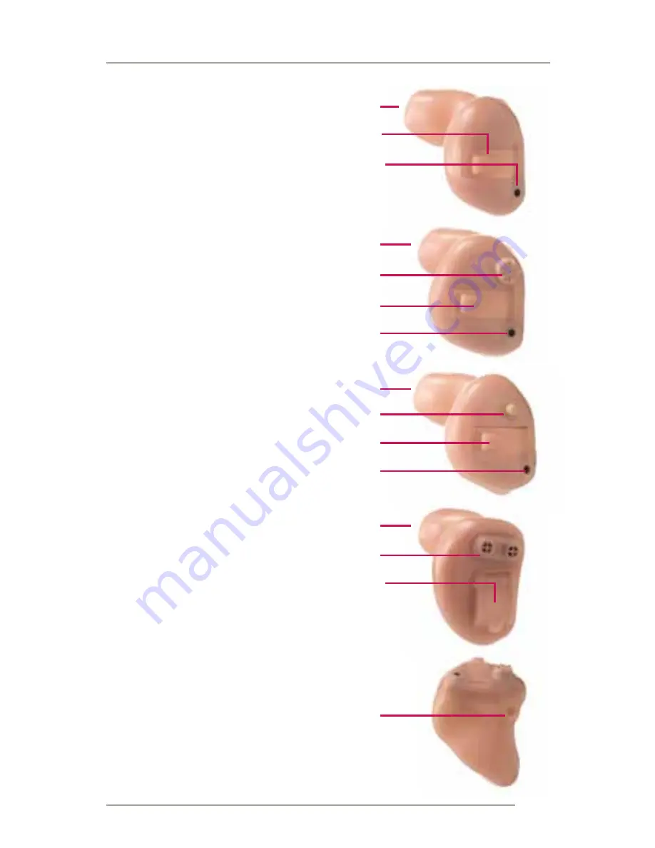 Microtech Radius ITC Operation Manual Download Page 5