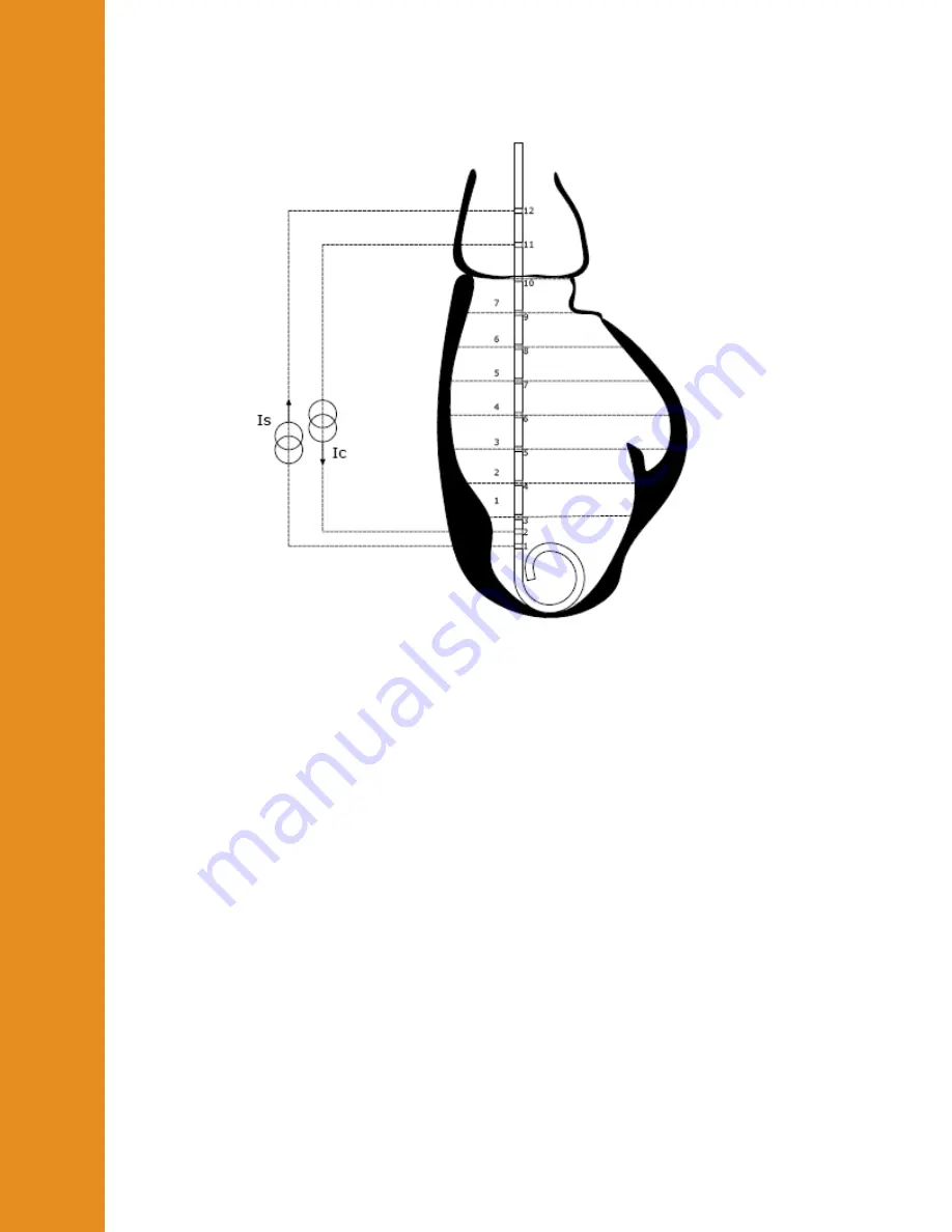 Millar MPVS Ultra User Manual Download Page 9