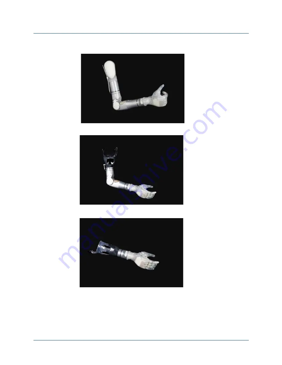 Mobius Bionics LUKE Arm User Manual Download Page 93