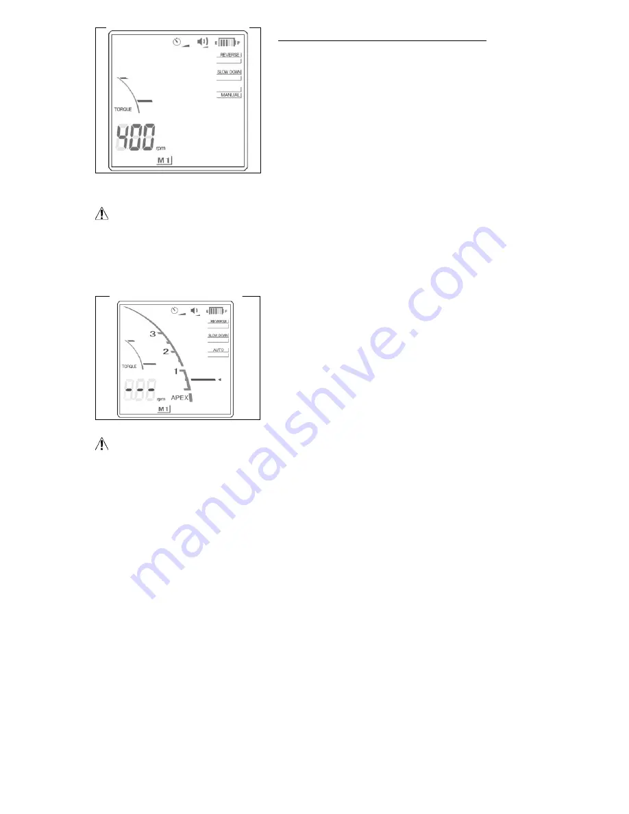 Morita ROOT ZX II Operation Instructions Manual Download Page 23