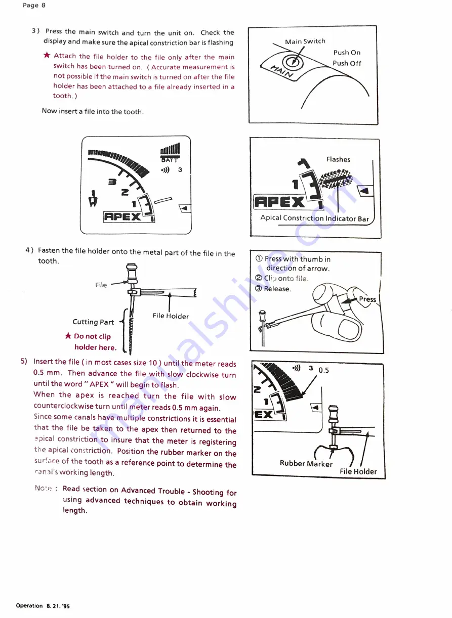 Morita ROOT ZX RCM-1 Скачать руководство пользователя страница 10