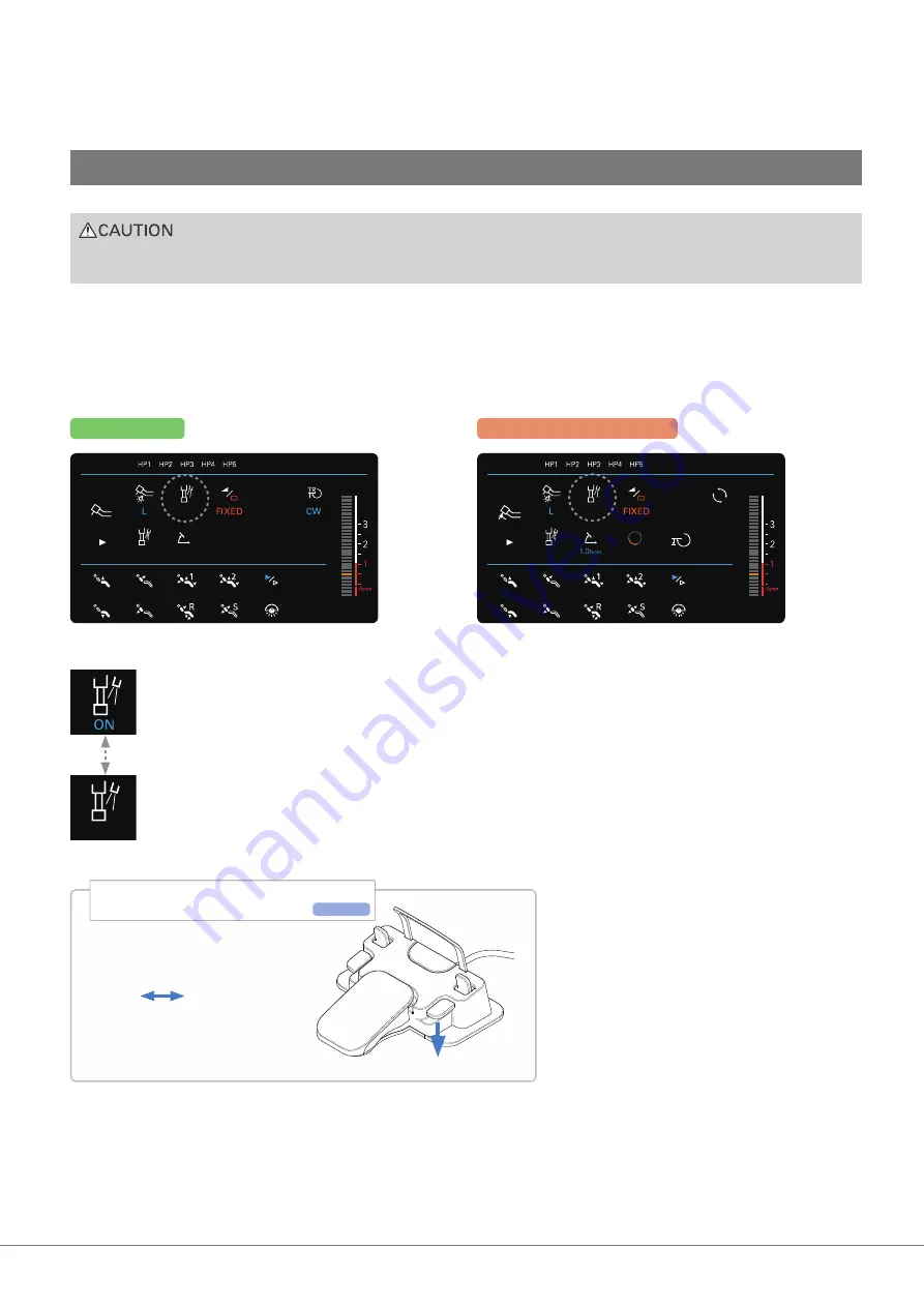 Morita Signo T500 Operation Instructions Manual Download Page 31