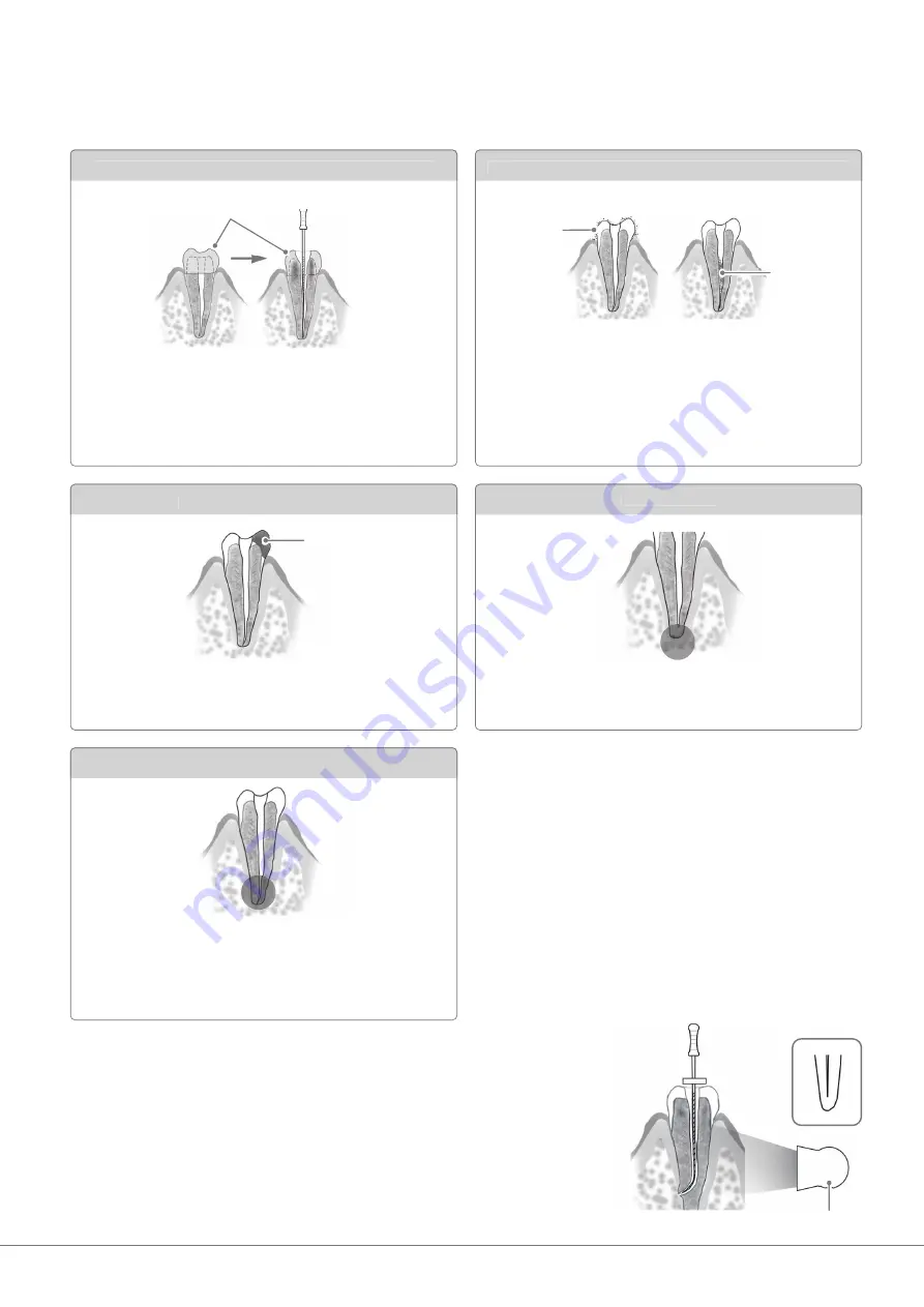 Morita Signo T500 Operation Instructions Manual Download Page 43