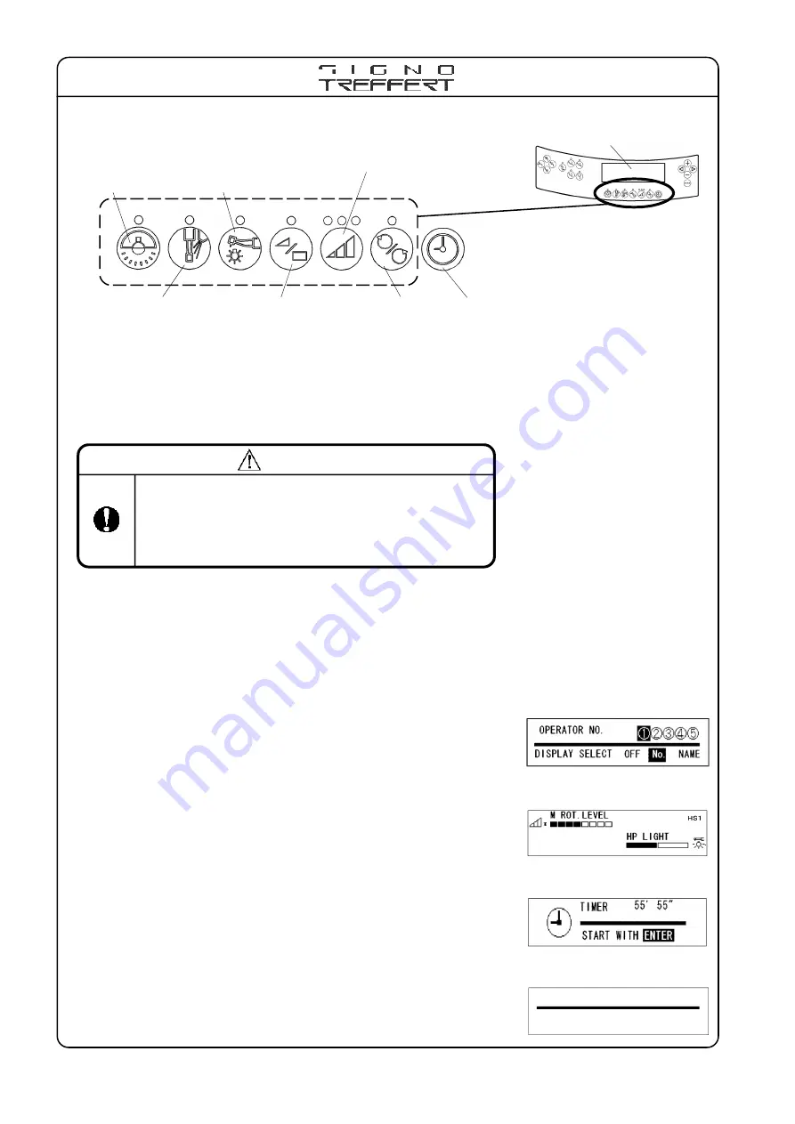 Morita Signo Treffert TU97 Operation Manual Download Page 22