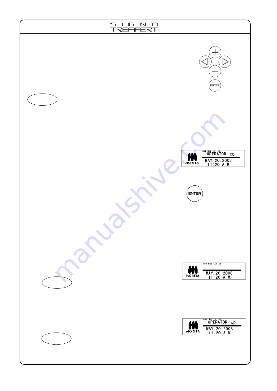 Morita Signo Treffert TU97 Operation Manual Download Page 26