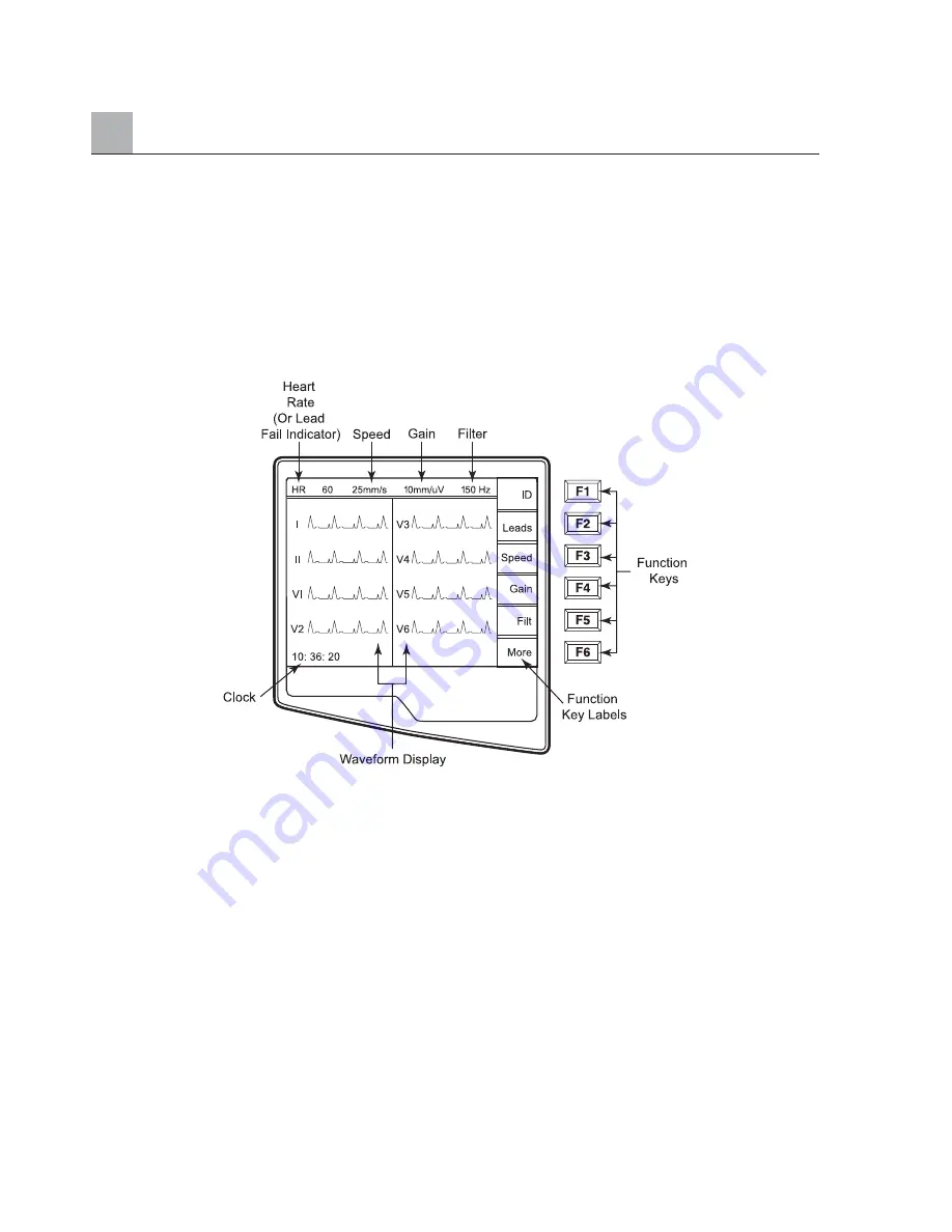 Mortara Instrument ELI 25O Скачать руководство пользователя страница 30