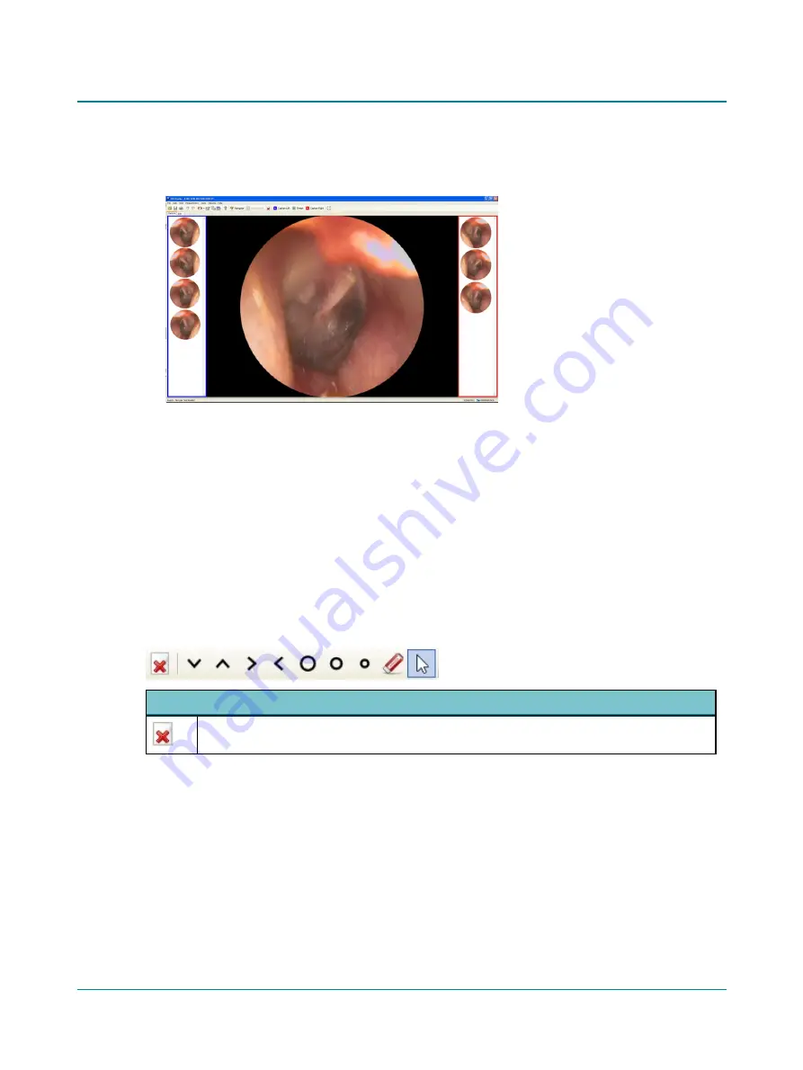 natus Aurical Otocam 300 Reference Manual Download Page 15