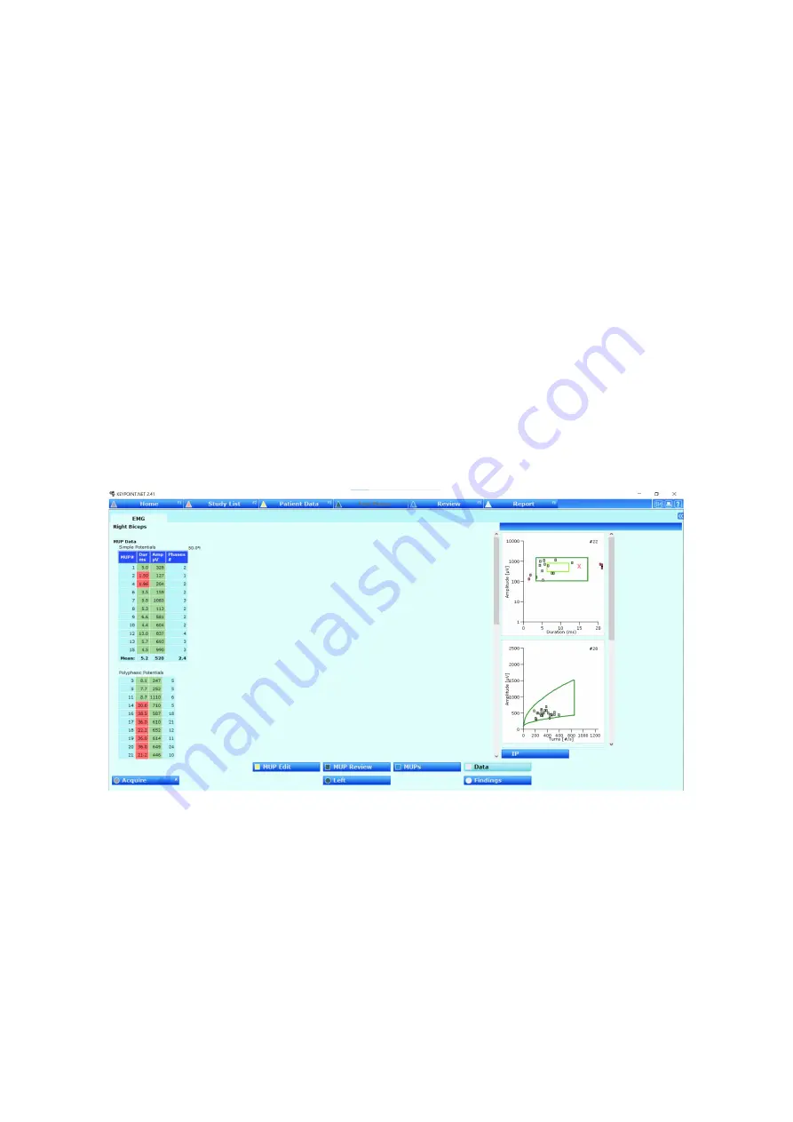 natus Dantec Keypoint G4 Скачать руководство пользователя страница 46