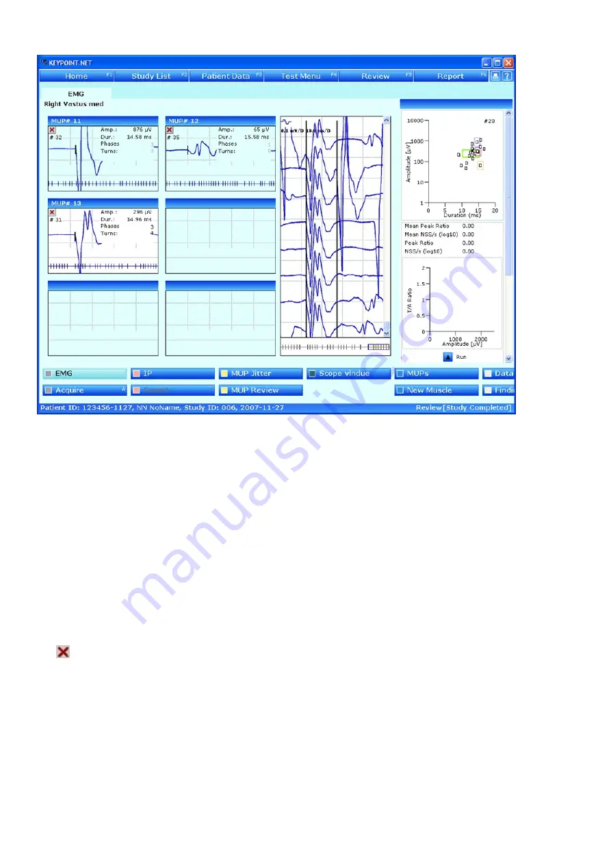 natus Dantec Keypoint G4 Скачать руководство пользователя страница 48