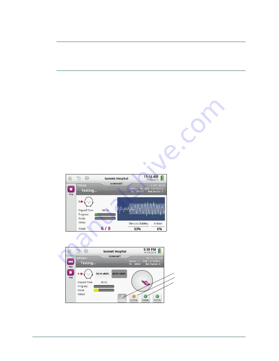 natus Echo-Screen III Pro Instructions For Use Manual Download Page 21