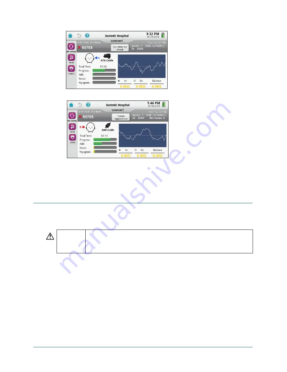 natus Echo-Screen III Pro Instructions For Use Manual Download Page 25