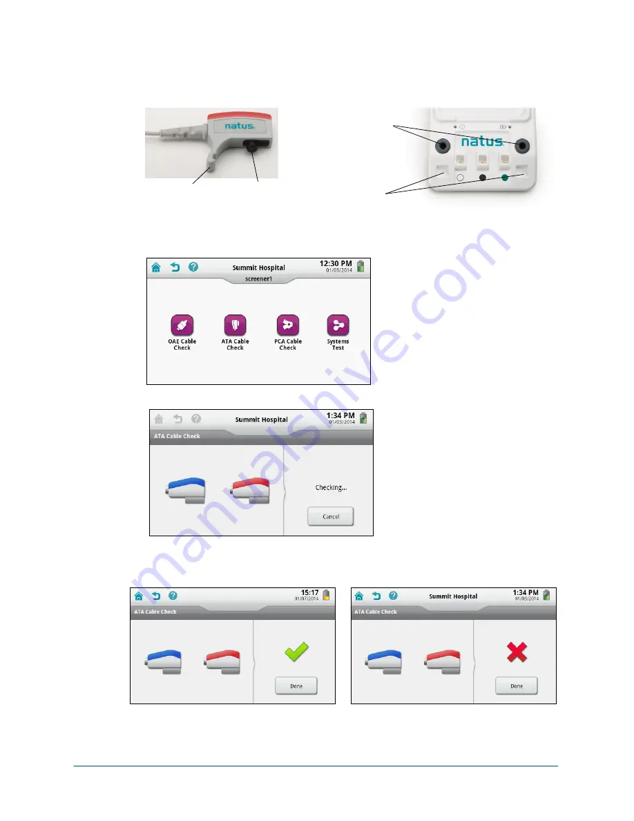 natus Echo-Screen III Pro Instructions For Use Manual Download Page 31