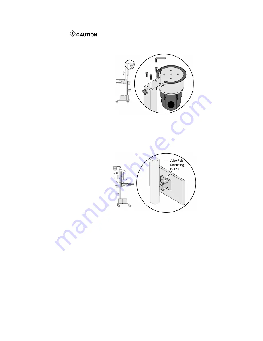 natus ErgoJust ICU Installation And Functionality Manual Download Page 40