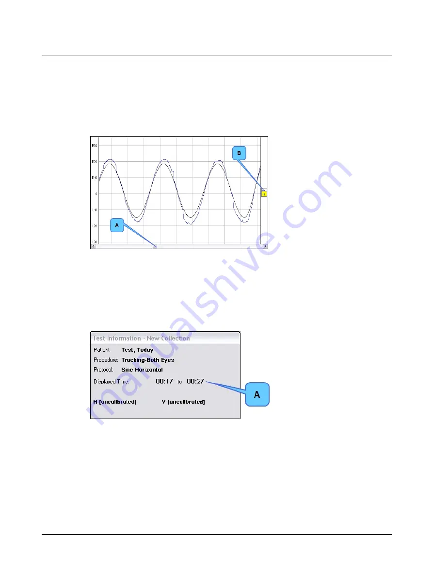 natus Otometrics ICS Chartr 200 VNG/ENG Скачать руководство пользователя страница 30