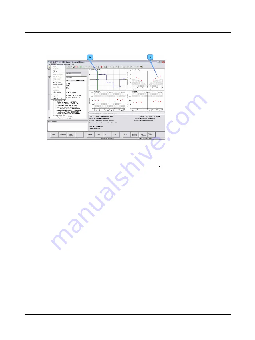 natus Otometrics ICS Chartr 200 VNG/ENG Installation And Startup Manual Download Page 33