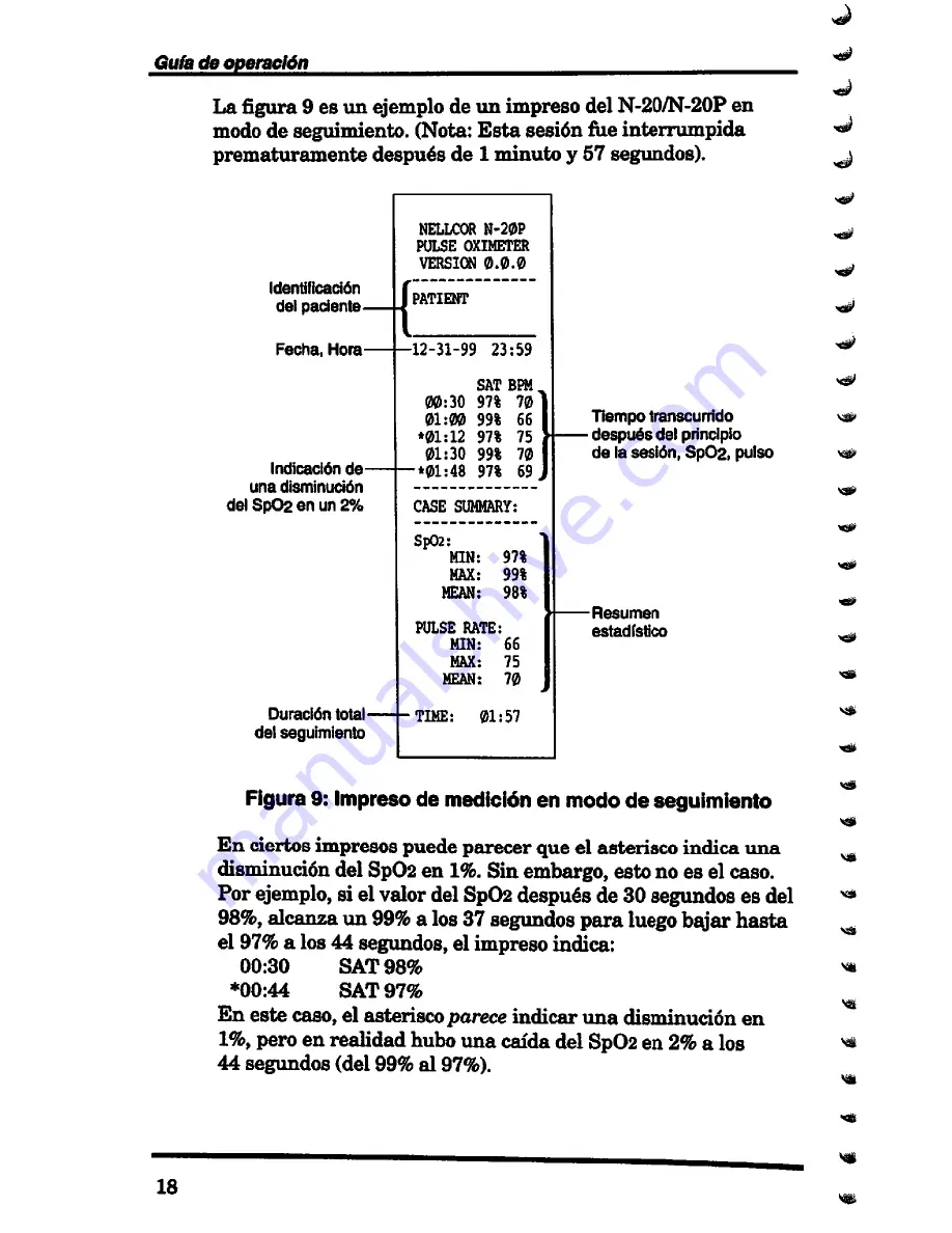 Nellcor N-20 Operator'S Manual Download Page 160