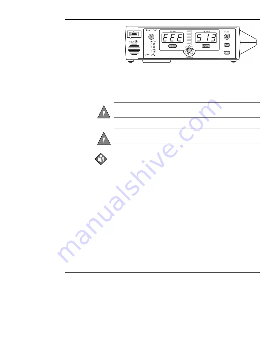 Nellcor OXIMAX N-560 Operator'S Manual Download Page 32