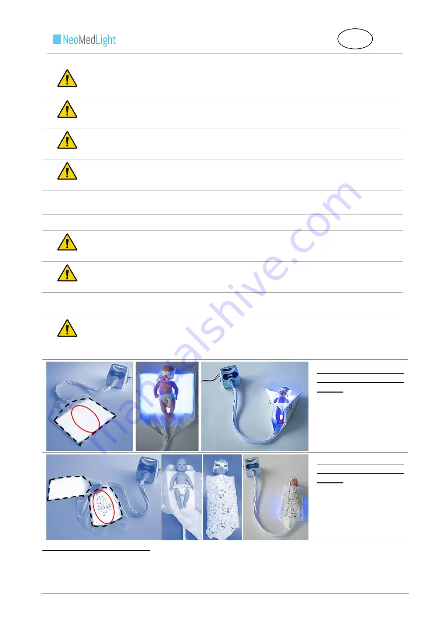 NeoMedLight BiliCocoon Bag System Скачать руководство пользователя страница 19