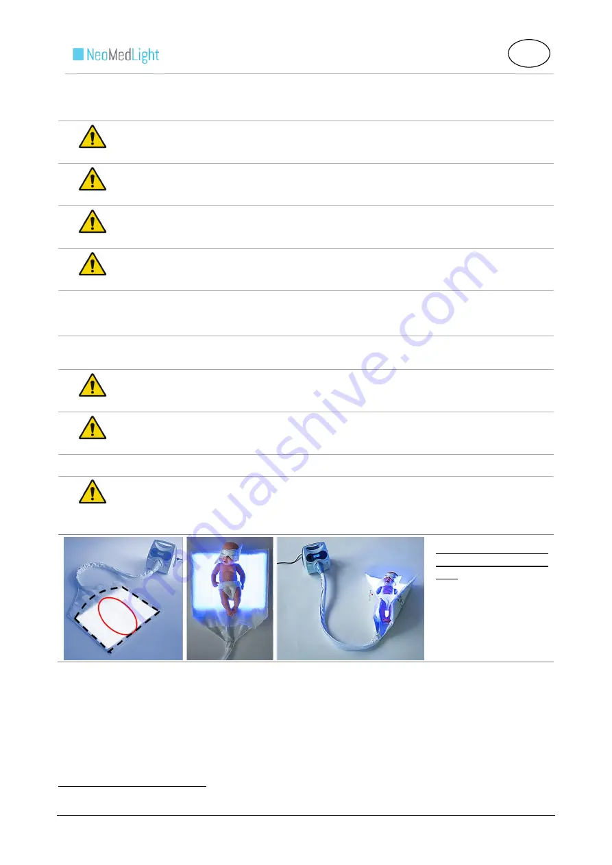 NeoMedLight BiliCocoon Bag System Скачать руководство пользователя страница 50