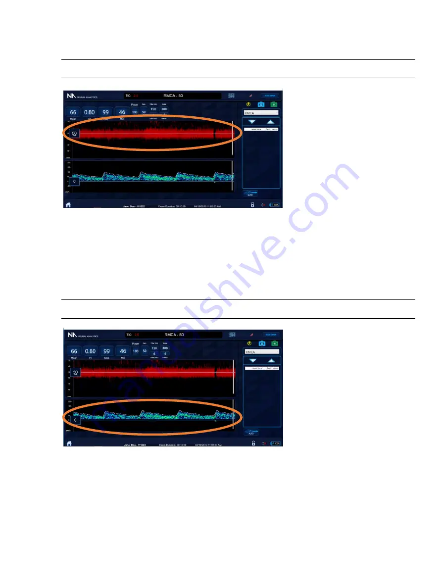 Neural Analytics Lucid M1 User Manual Download Page 29