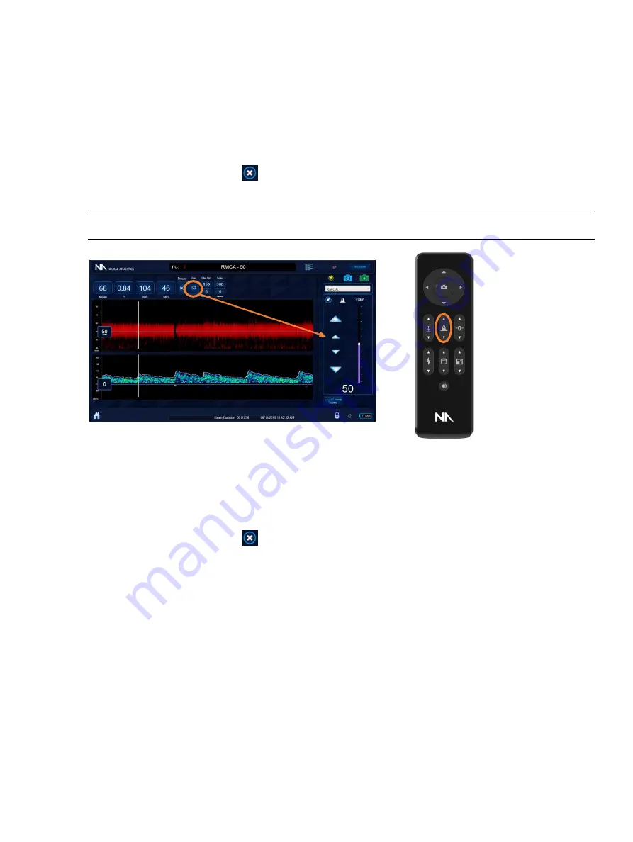 Neural Analytics Lucid M1 Скачать руководство пользователя страница 32