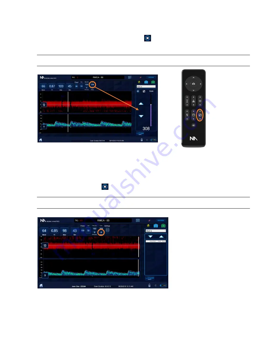 Neural Analytics Lucid M1 Скачать руководство пользователя страница 34