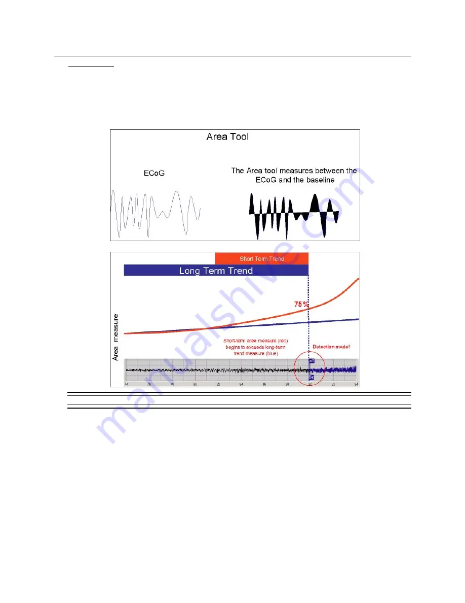 Neuropace NeuroPace CL-315-10 Скачать руководство пользователя страница 73