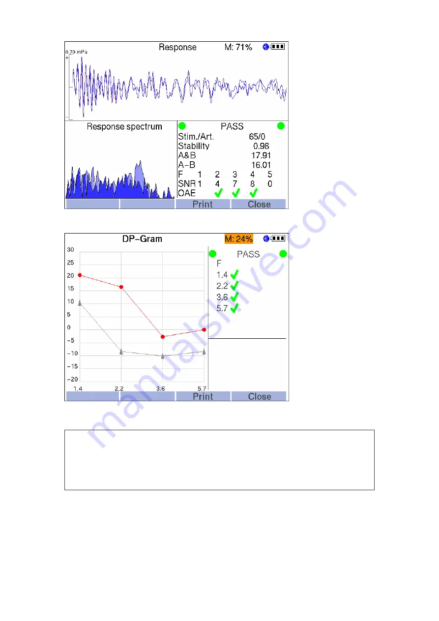 Neurosoft Neuro-Audio-Screen Technical Manual Download Page 47