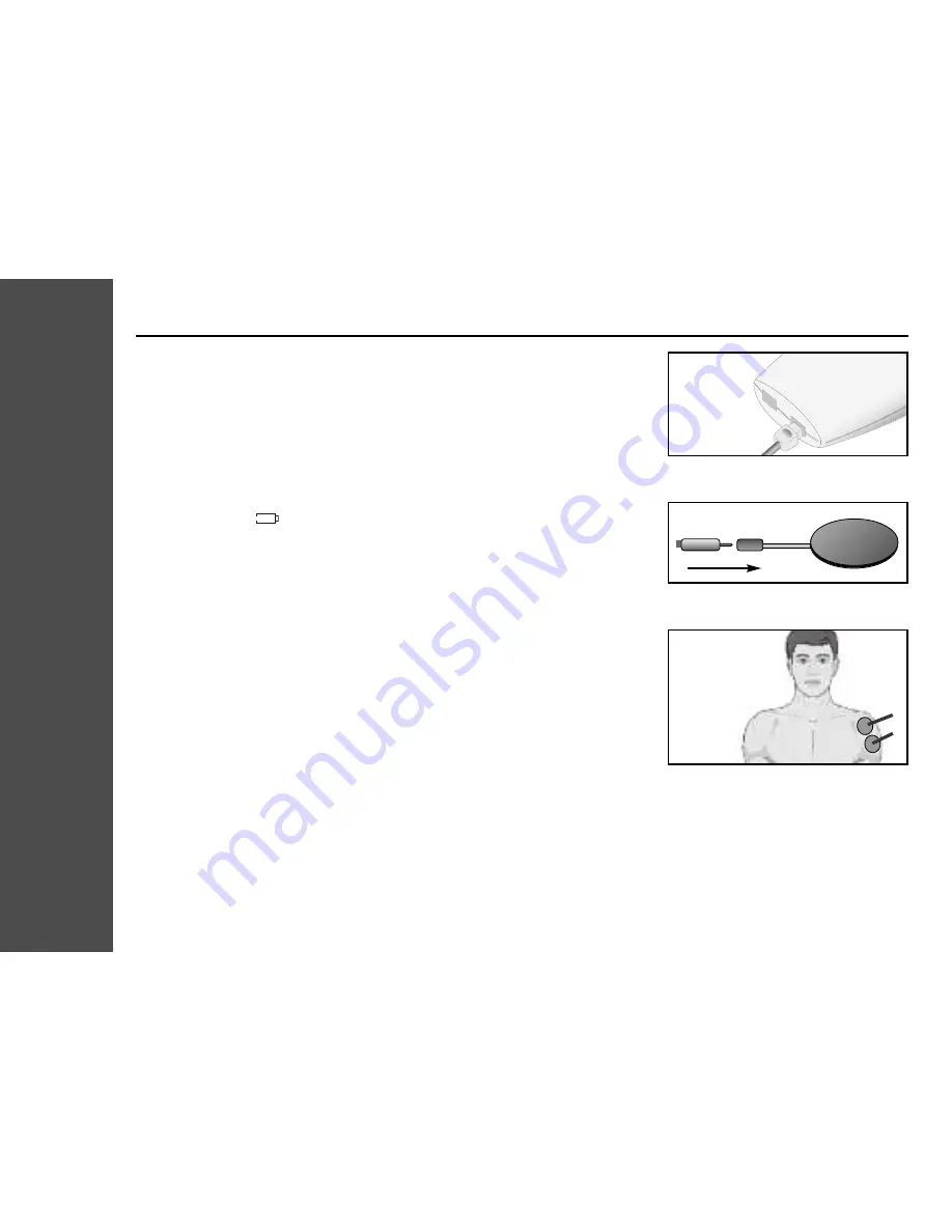 Neurotech AvivaTens XP Instructions For Use & Warranty Download Page 14