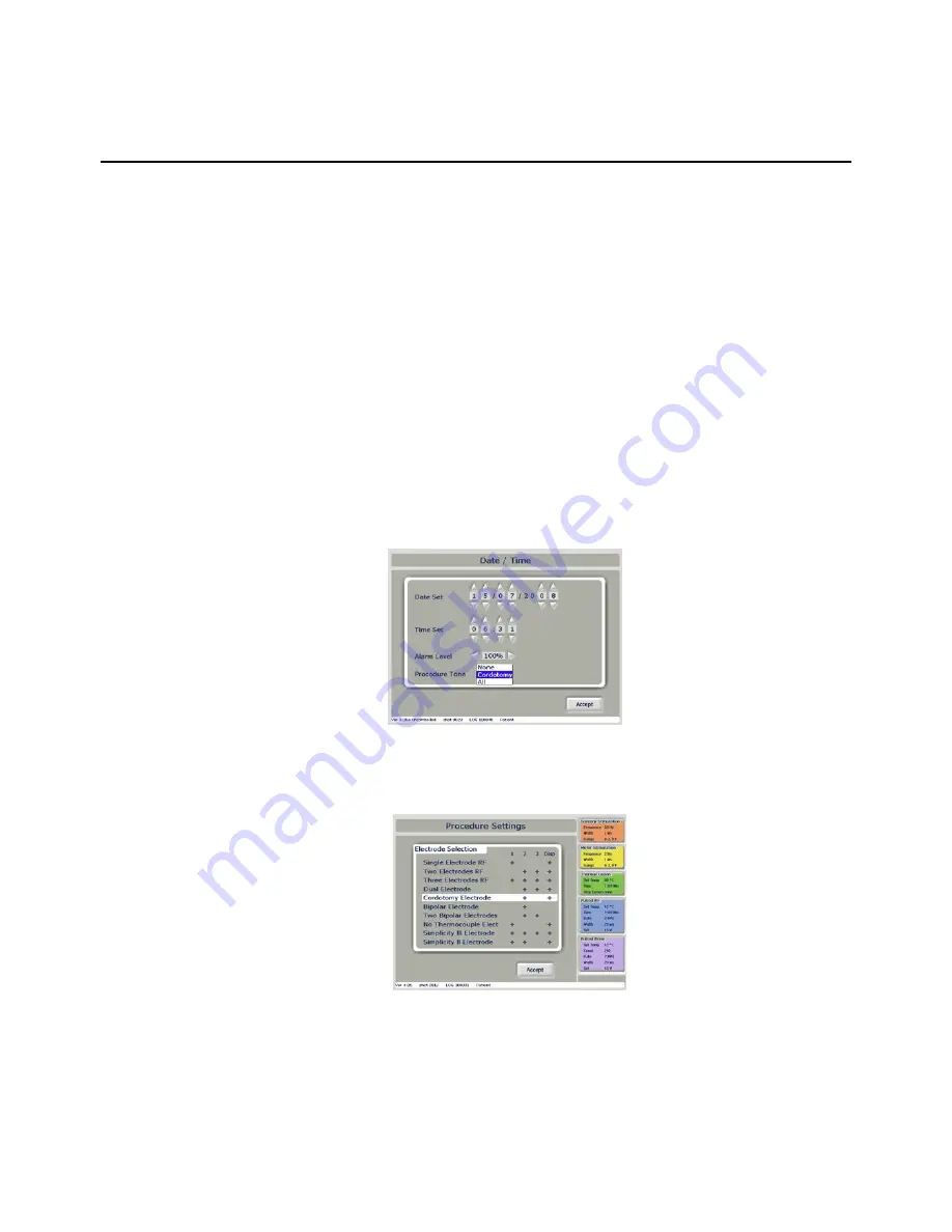 NeuroTherm NT1100 Operator'S Manual Download Page 61