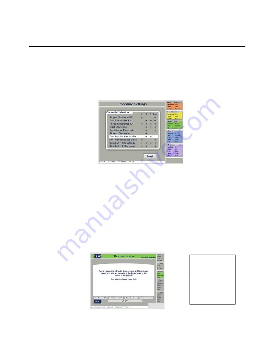 NeuroTherm NT1100 Operator'S Manual Download Page 62