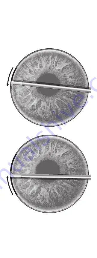 New World Medical Kahook Dual Blade Manual Download Page 3